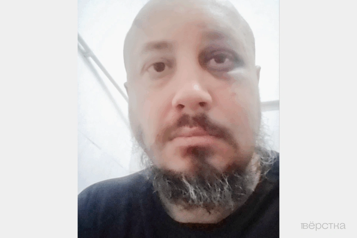 Выживальщик Владимир Бернгардт, избитый после задержания