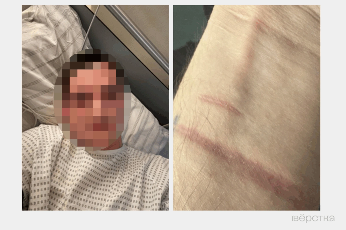 В соответствии с новым расписанием болезней психические заболевания — не повод к признанию негодными. Таких людей отправляют на фронт