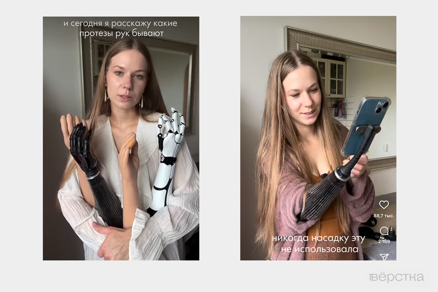 Качественные протезы рук позволяют повторять основные движения, но Социальный фонд может отказать в их покупке — стоят такие протезы слишком дорого